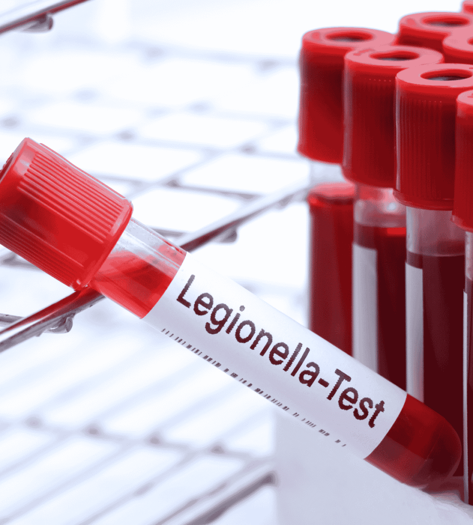 legionella outbreak investigation