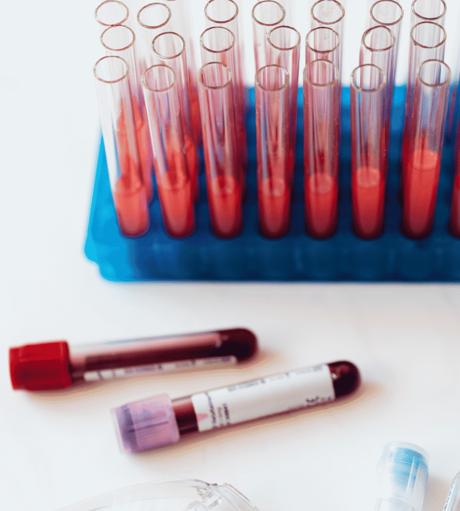 Legionella Testing and Sampling Interpretation